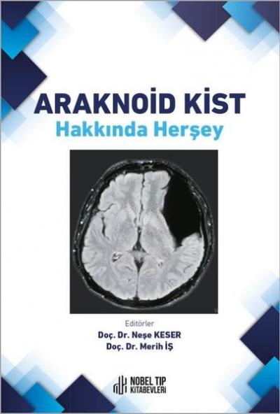 Araknoid Kist Hakkında Herşey Merih İş