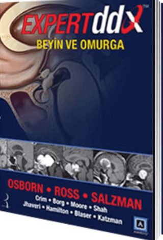 Expert DDX: Beyin ve Omurga Anne G. Osborn