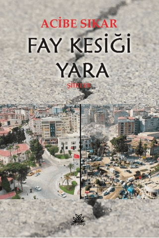 Fay Kesiği Yara Acibe Sıkar