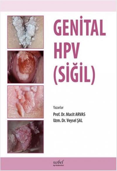 Genital HPV (Siğil) Macit Arvas