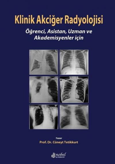 Klinik Akciğer Radyolojisi Prof.Dr. Cüneyt Tetikkurt