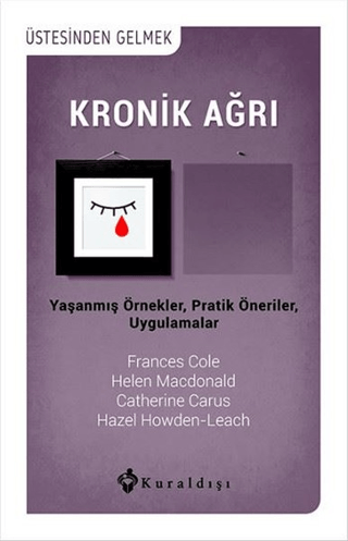 Kronik Ağrı Frances Cole