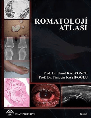 Romatoloji Atlası (Ciltli) Umut Kalyoncu