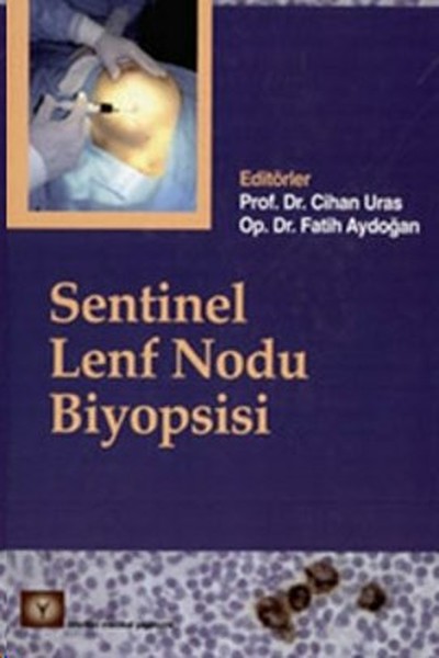 Sentinel Lenf Nodu Biyopsisi Kolektif