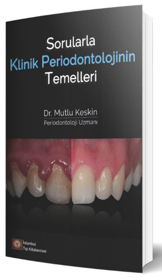 Sorularla Klinik Periodontolojinin Temelleri Mutlu Keskin